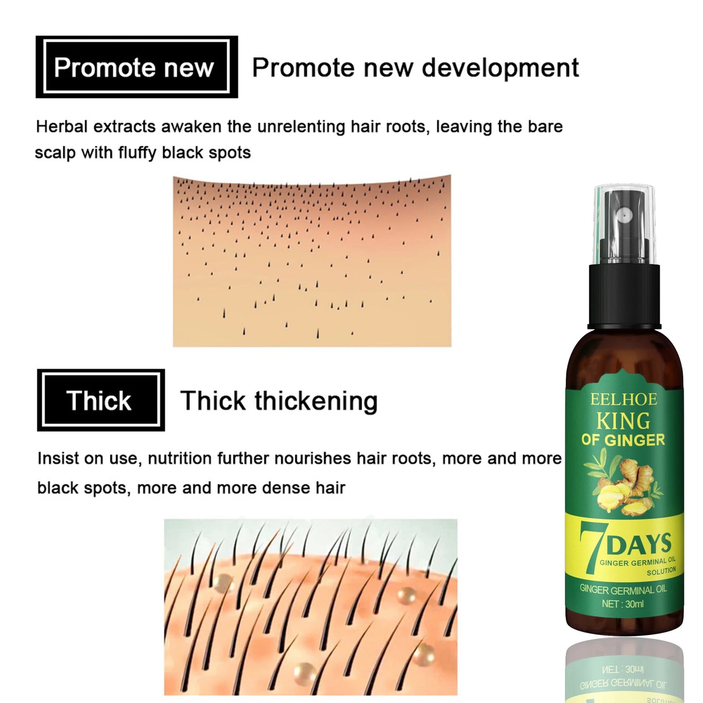 Ginger Care Hair Spray Hair Growth Essence Nourish Hair Roots Massag Scalp Repair Hair Quality Control Oil Hair Care Solution
